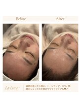 ラルーナ(LA LUNA)/実力派サロンです