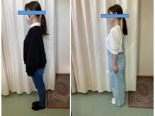 やえざきカイロプラクティック/姿勢矯正before＆afuter