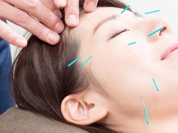 ハンズ治療院 整骨院/美容鍼