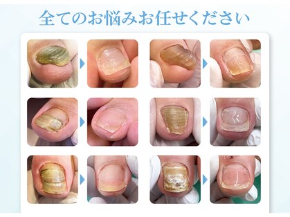 東京巻き爪補正店の写真