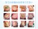 東京巻き爪補正店の写真