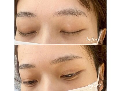 スターフェイス 天神店(Star Face)の写真