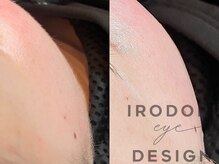 フェイシャルワックス