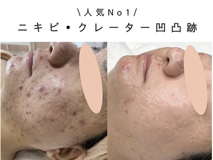 アロマ(AROMA)の写真