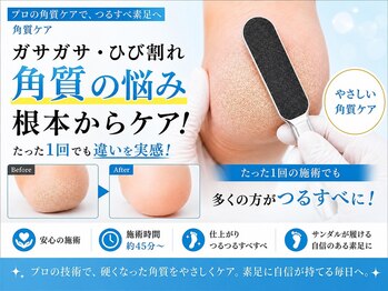 フットブルー 銀座店の写真/創業1998年｜ガサガサかかと・痛い魚の目・繰り返す角質に◆女性専用フットケア専門店
