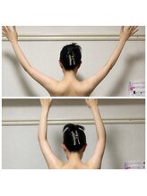 サロンシファ(salon sifa)/術後ケア