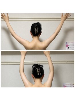 サロンシファ(salon sifa)/術後ケア