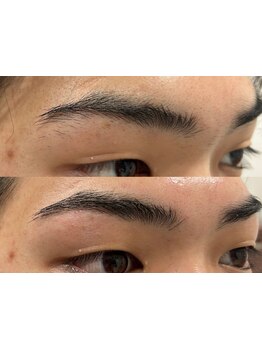 パーツ脱毛のできるサロン