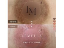 エム(M MaKe yourself shine)の雰囲気（ルメラメラニンケア）