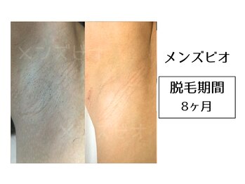 メンズビオ 神戸三宮店/