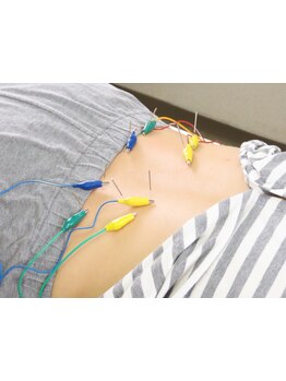 鍼灸施術を受けたい