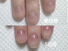 アメジスト(Amethyst)の雰囲気（深爪改善で理想の指先を目指します♪お悩みご相談ください）