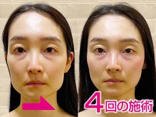 ネルジム 札幌店(NERU GYM)の雰囲気（★１回でも大きく変化します★数回やればこのくらい変わります★）