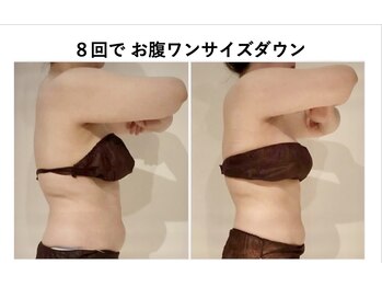 ナチュラーレ 天王寺店(Naturale)/痩身美脚リンパマッサージ二の腕