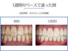 エクシアホワイトニング 岡崎店/感動の変化★岡崎No.1の来店者数