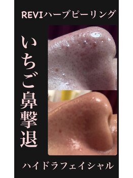 マヤヒメ(mayahime)/お鼻の悩み解決