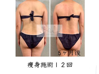 アイ エステサロン(Ai)/【40代半】疲れにくくなった♪