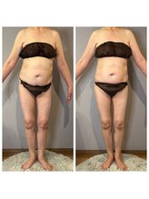 エネイブル(ENable)/