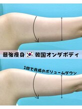 カンナムビューティー オンダ 痩身
