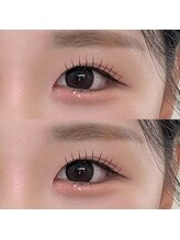 ソア 並木坂店(Soa)/奥2重さんもパッチリまつ毛♪