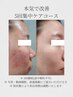 【肌質改善】本気で肌を変えたい方へ ダクトピール集中コース（5回）