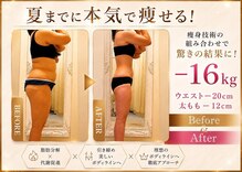 クリニカルエステ/イーズ 六甲アイランド店