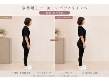 マハナ(mahana)の写真/【1回で違いが分かる!!話題のフェムケア矯正】足先から頭まで矯正して歪みを整え、施術後の違いを実感♪