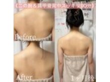 ソウビ(SowVi)の雰囲気（肩甲骨メリハリ4分割の背中でドレスが更に映える！これ大切）