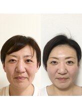 エフ(f)/肩首背中の疲れにも小顔コルギ！