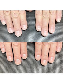 ルクレール カシェット(Le clair cachette)/美爪育成ケアコース