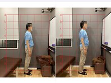 摂津本山駅前鍼灸整骨院/ビフォーアフターになります！