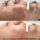 ティアス(t-us)