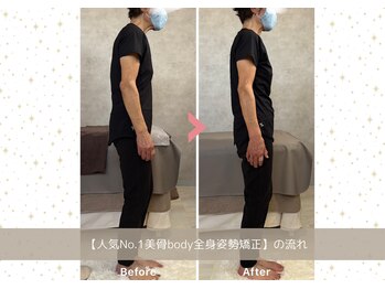 シュガー 津市(Sugar)/4［BeforeAfter］毎回記録します