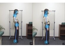 整骨院こころ 曙院/ビフォーアフター