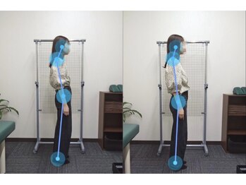 整骨院こころ 曙院/ビフォーアフター