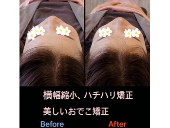 美容矯正サロン レレポノ(LELEPONO)/