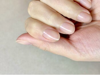ソエル(soel)の写真/自爪ケアで磨く指先に、シンプルが格別の輝きを宿す◆ハンド・フットの爪や乾燥にお悩みの方にお勧め◎