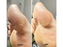 ラヴィ(La vie)の雰囲気（春に向けてカサつく足裏ケア♪）