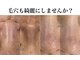ヒルナム(Heal Nam)の写真