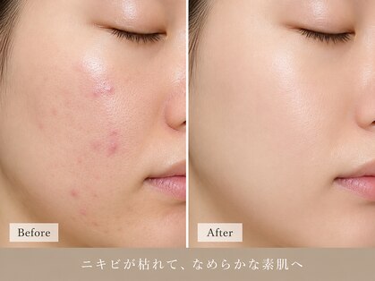 オニュ(onyu)の写真