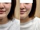 アークス(ARQS)の写真/むくみをケアして目指す速攻小顔効果＆リフトアップ！心地よい施術で理想のフェイスラインをサポート◎