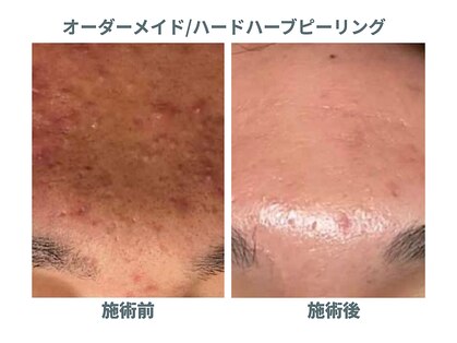 プラスボーテ 幡ヶ谷(plus beaute)の写真