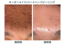 プラスボーテ 幡ヶ谷(plus beaute)