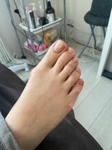 グリーングリーン(GREEN GREEN)/爪のお悩みbefore