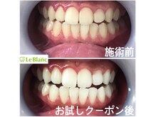 ルブラン 奈良店(Le Blanc)/30分が楽しみと思える時間！