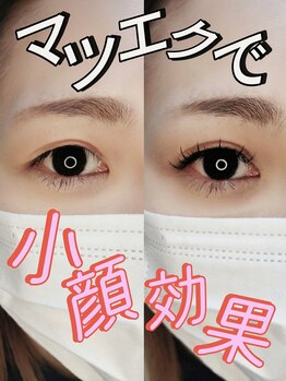 アヴァンセ(avancer)/マツエクで小顔効果