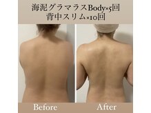 エステ大阪PONの雰囲気（[痩身]むくみ改善☆お顔とのセットで効果up◎）