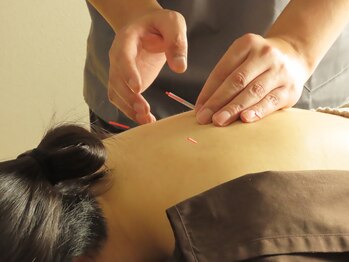 ライズ鍼灸院整骨院 所沢駅 秋津駅(RISE鍼灸院整骨院)/鍼灸