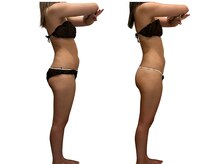 アイル(Isle)/内臓ケアできるのはWINBACKだけ!