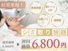 【低刺激・ダウンタイム×・再発リスク×】シミケア放題エステ30分¥8,800→